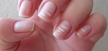 انتبهي لأظافرك.. علامة صامتة قد تكشف خطرا صحيا لا ترينه