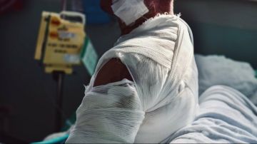 جراح تجميل: إنشاء بنك جلد قضية أمن قومي لعلاج مرضى الحروق.. فيديو جراح تجميل: إنشاء بنك جلد قضية أمن قومي لعلاج مرضى الحروق.. فيديو