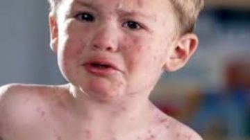 ولاية بالمكسيك تستضيف كأس العالم 2026 تعاني من تفشي مرض شديد العدوى يهدد مشجعي كرة القدم قبل المونديال ولاية بالمكسيك تستضيف كأس العالم 2026 تعاني من تفشي مرض شديد العدوى يهدد مشجعي كرة القدم قبل المونديال