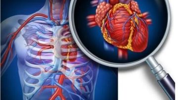 هؤلاء الأكثر عرضة لتصلب الشرايين