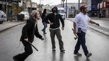 إصابة فلسطيني جراء اعتداء مستوطنين عليه في بلدة النبي صموئيل إصابة فلسطيني جراء اعتداء مستوطنين عليه في بلدة النبي صموئيل