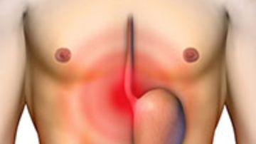 أفضل الطرق الطبيعية لعلاج مشكلات الهضم