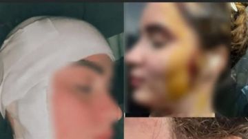 المراية عدوتي .. بلطجي ينهي أحلام رحمة الموديل بـ49 غرزة في الوجه المراية عدوتي .. بلطجي ينهي أحلام رحمة الموديل بـ49 غرزة في الوجه