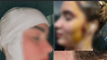 19 فبراير أولى جلسات محاكمة المتهم بتشويه وجه فتاة بـ 49 غرزة في العجوزة