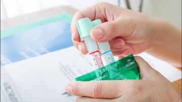 اختبارات صحة الأمعاء المنزلية قد تعطي نتائج مضللة.. دراسة تحذر اختبارات صحة الأمعاء المنزلية قد تعطي نتائج مضللة.. دراسة تحذر