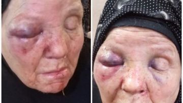 عاق ومدمن.. حبس الابن المعتدي بالضرب علي أمه بزفتي 4 أيام القصة الكاملة عاق ومدمن.. حبس الابن المعتدي بالضرب علي أمه بزفتي 4 أيام القصة الكاملة