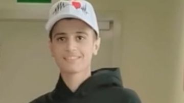 بعد 45 عملية جراحية وحروق تجاوزت 75 .. طفل يستعيد الحياة بنجاح أول زراعة جلد في مصر