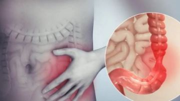 ماهو التهاب القولون التقرحي وأهم أعراضه