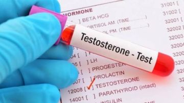 دراسة: ارتفاع هرمون التستوستيرون قد يزيد خطر إصابة الرجال بأمراض القلب دراسة: ارتفاع هرمون التستوستيرون قد يزيد خطر إصابة الرجال بأمراض القلب