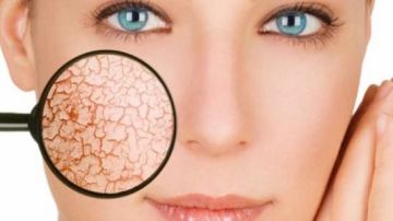 علاج جفاف البشرة بمكونات طبيعية من المنزل علاج جفاف البشرة بمكونات طبيعية من المنزل