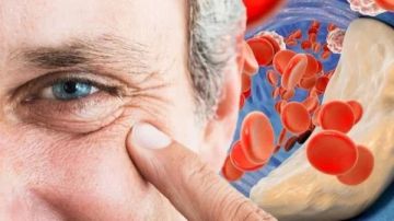 نوع ياميش غير متوقع يخفض الكوليسترول بالدم نوع ياميش غير متوقع يخفض الكوليسترول بالدم