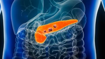 تظهر قبل سنوات.. اكتشاف إشارة تحذير مبكرة لسرطان البنكرياس