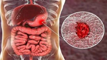 ماذا يحدث للقولون خلال صيام شهر رمضان؟ طبيب يوضح
