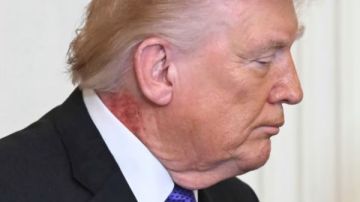 كريم شائع .. طبيب البيت الأبيض يكشف سبب طفح جلدي على رقبة ترامب