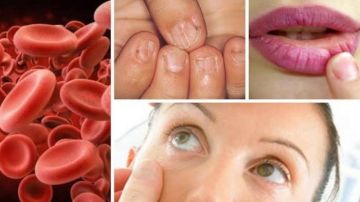 تحمي من فقر الدم أطعمة غنية بالحديد يجب أن تكون على سفرتك في رمضان