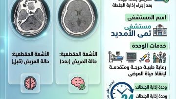 الدقهلية.. نجاح أول حالة بوحدة إذابة الجلطات بمستشفى تمي الأمديد