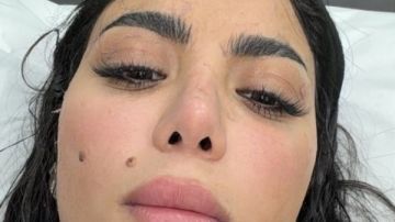 كارولين عزمي تتعرض لـ إصابة في رامز ليفل الوحش.. شاهد