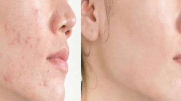 عشبة الجمال والروقان .. نبات غير متوقع يعالج مشاكل البشرة والشعر ويحسن المزاج