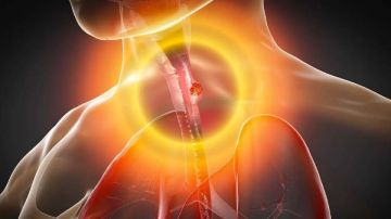 الارتجاع الحمضي .. أعراضه ونصائح للتعامل معه