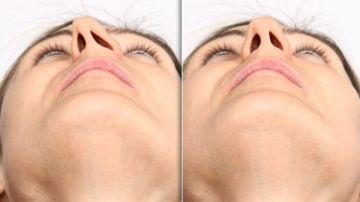 انحراف الحاجز الأنفي.. أسباب لا تتوقعها عن الشخير أثناء النوم