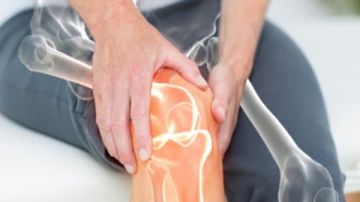 6 أطعمة أساسية لتقليل خطر كسور العظام لدى مرضى الهشاشة