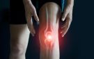 أسباب وأعراض التهاب المفاصل.. تغيير نمط الحياة بداية العلاج