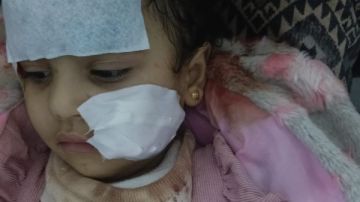 أول ظهور لوالدة ضحية الأسد في السيرك : مش إهمال منا .. والشبل هاجم بنتي فجأة