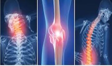 خشونة المفاصل.. أسبابها وطرق السيطرة عليها بدون جراحة
