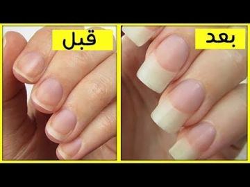 هتبقى جميلة وقوية .. طرق علاج تقصف الأظافر