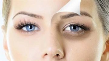 علاج الهالات السوداء بأسهل وأرخص الطرق علاج الهالات السوداء بأسهل وأرخص الطرق