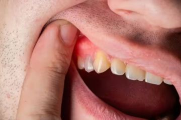 14 تغييرا في العادات اليومية تعالج التهابات اللثة 14 تغييرا في العادات اليومية تعالج التهابات اللثة