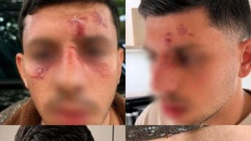 تحدث بالعبرية.. علقة ساخنة لإسرائيلي في لندن تحدث بالعبرية.. علقة ساخنة لإسرائيلي في لندن
