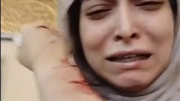 بعد الاعتداء عليها.. تفاصيل الحالة الطبية لطبيبة أسنان شبرا الخيمة بعد الاعتداء عليها.. تفاصيل الحالة الطبية لطبيبة أسنان شبرا الخيمة