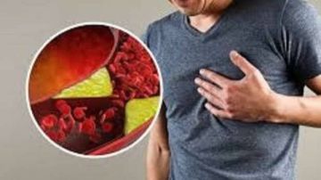 نبات غير متوقع يخفض الضغط والكوليسترول نبات غير متوقع يخفض الضغط والكوليسترول