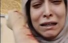 بعد الاعتداء عليها.. تفاصيل الحالة الطبية لطبيبة أسنان شبرا الخيمة