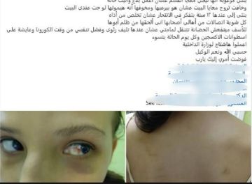 كدمات على جسدها.. ضبط شخص تعدى على طفلته بسبب زواج طليقته بالدقهلية كدمات على جسدها.. ضبط شخص تعدى على طفلته بسبب زواج طليقته بالدقهلية