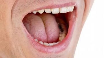 جفاف الفم رغم شرب المياه.. أسباب غير متوقعة وراء المشكلة جفاف الفم رغم شرب المياه.. أسباب غير متوقعة وراء المشكلة
