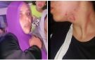 اعتداء لفظي وجسدي.. سيدة تنهال على فتاة بالضرب والعض داخل ميكروباص وتشوه وجهها - eg