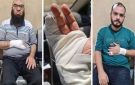 واقعة مستشفى حوش عيسى في البحيرة.. تفاصيل الاعتداء على طبيبين عظام