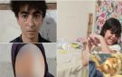 بعد عقرها وإصابتها بالسعار.. أسرة ببورسعيد تستغيث: بنتنا بين الحياة والموت