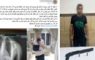 أطلق عليهم النار.. القبض على المتهم بإصابة شخصين فى مشاجرة بالإسماعيلية