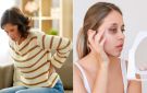 تورم العين وتغير لون البشرة أبرزها .. 5 علامات على الوجه تكشف وجود مشكلات في الكلى