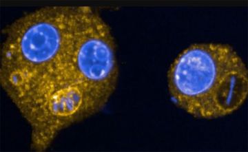 منظمة الصحة العالمية تحذر من انتشار بكتيريا قاتلة منظمة الصحة العالمية تحذر من انتشار بكتيريا قاتلة