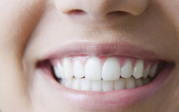 طريقة بسيطة وعملية لحماية الأسنان من التسوس طريقة بسيطة وعملية لحماية الأسنان من التسوس