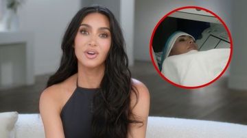 ما هو تمدد الأوعية في الدماغ الذي أصيبت به كيم كارداشيان؟ ما هو تمدد الأوعية في الدماغ الذي أصيبت به كيم كارداشيان؟
