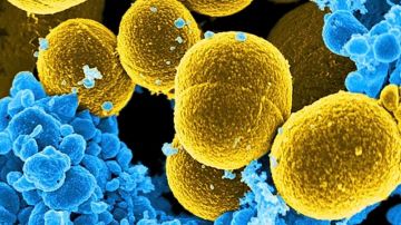 فيروسات ملتهمة للبكتيريا تساعد على علاج أخطر أنواع العدوى البكتيرية