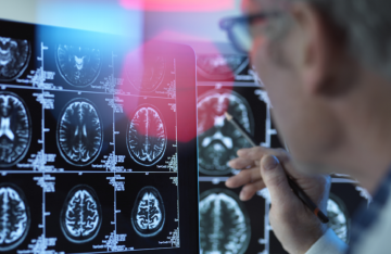 دراسة تسلط الضوء على أحد أخطر تأثيرات التدخين الخفية دراسة تسلط الضوء على أحد أخطر تأثيرات التدخين الخفية