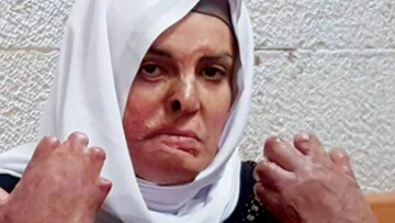 الأسيرة المحررة جعابيص تجري عمليتها الجراحية الـ 20 في الأردن الأسيرة المحررة جعابيص تجري عمليتها الجراحية الـ 20 في الأردن
