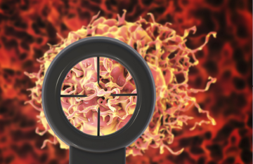 اكتشاف جديد يمهد لتطوير علاج فعال لسرطان البروستات