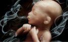 التدخين وتأثيره على تشوهات الجنين - jo
